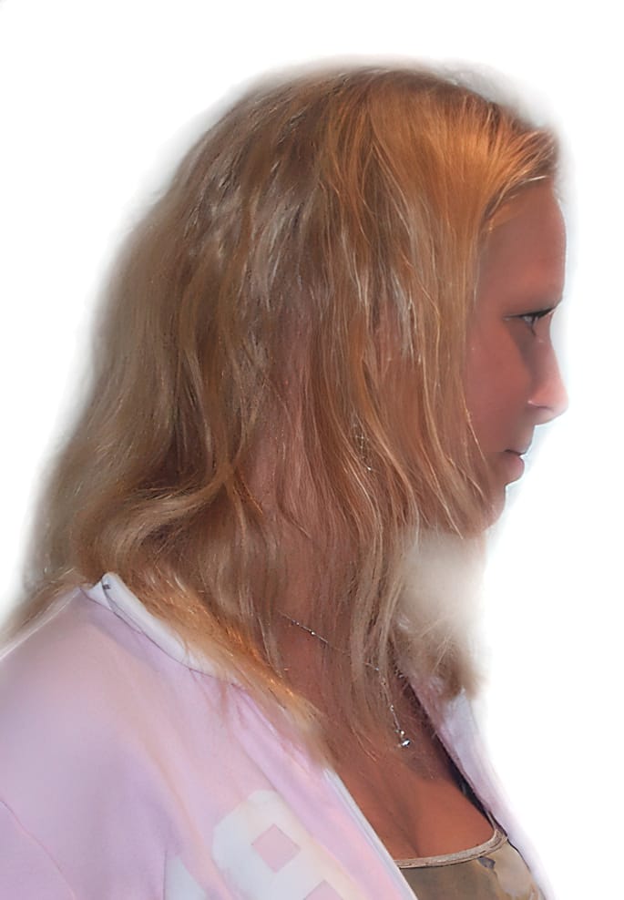 Before Picture - Home Bleaching Damage Transformed - Long Blonde